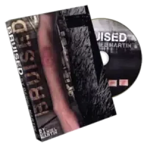 Bruised by Daniel Martin