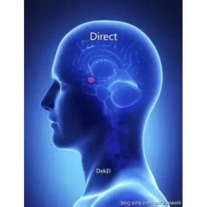 Direct by Bill Dekel